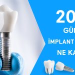 2025 implant fiyatları