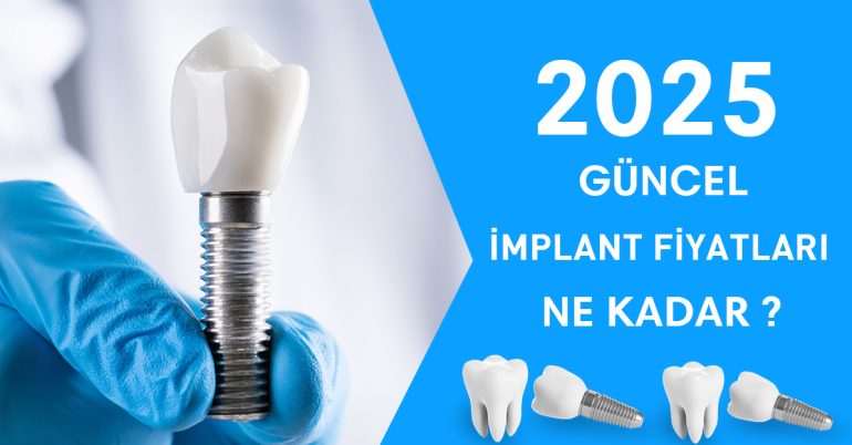 2025 implant fiyatları